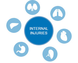 internal-injuries-in-car-accidents1